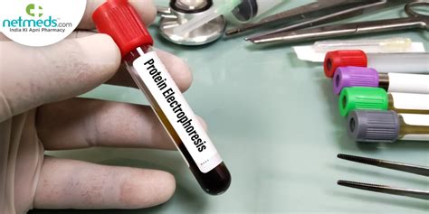 spep blood test bottle|blood bottle toxicology test.